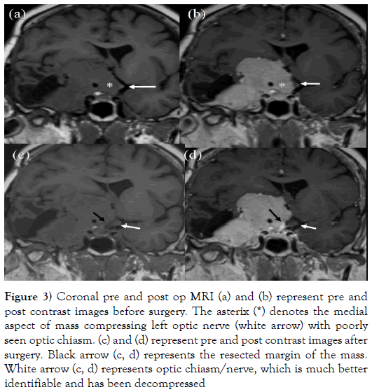 the-neurosurgery-journal-before-surgery