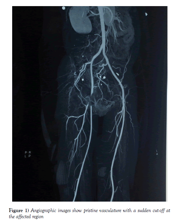 vascular-diseases-treatment-pristine-vasculature