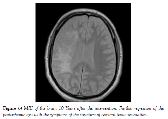 vascular-diseases-treatment-structure-cerebral